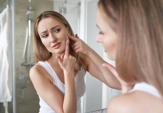 Routine anti-acné 100% naturelle : soins bio pour retrouver une peau saine